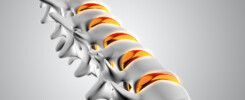 Scoliosi-nei-bambini-l'efficacia-dell'osteopatia-nella-correzione-posturale